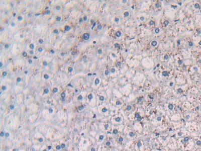 Polyclonal Antibody to Monocyte Chemotactic Protein 1 (MCP1)