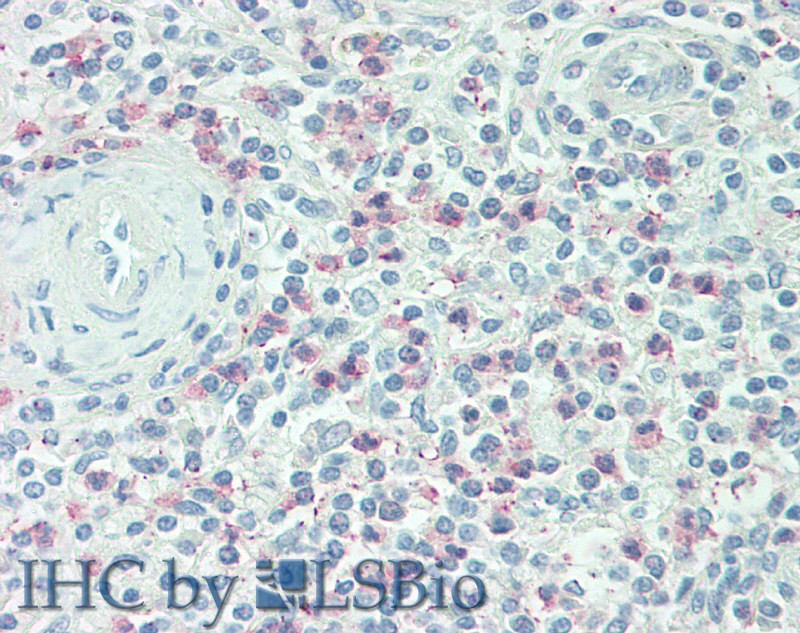 Polyclonal Antibody to Macrophage Inflammatory Protein 3 Beta (MIP3b)