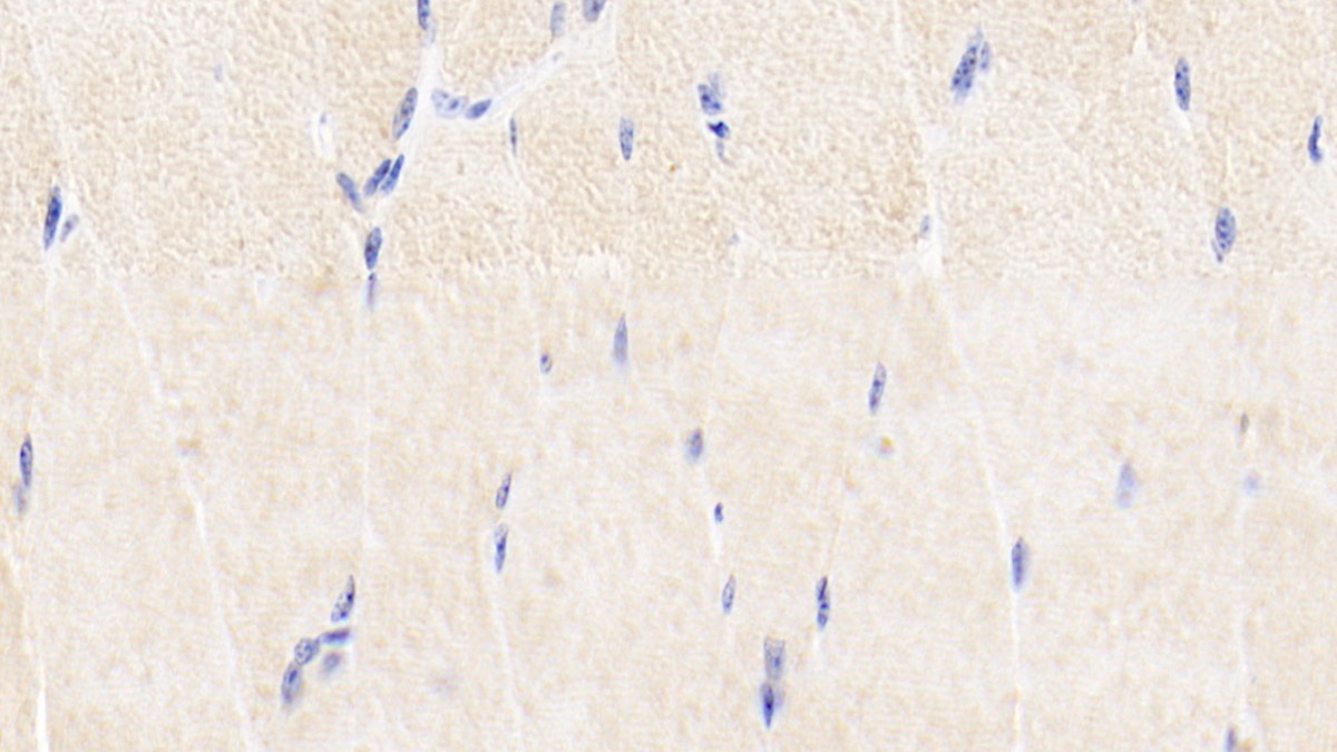 Polyclonal Antibody to Matrix Metalloproteinase 1 (MMP1)