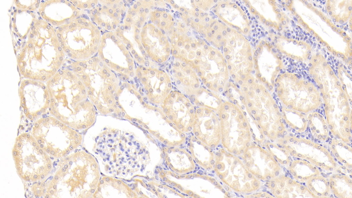 Polyclonal Antibody to Matrix Metalloproteinase 1 (MMP1)