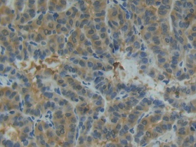 Polyclonal Antibody to Matrix Metalloproteinase 13 (MMP13)