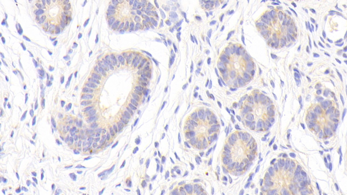 Polyclonal Antibody to Matrix Metalloproteinase 13 (MMP13)