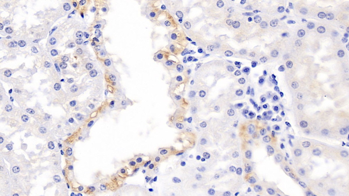 Polyclonal Antibody to Matrix Metalloproteinase 3 (MMP3)