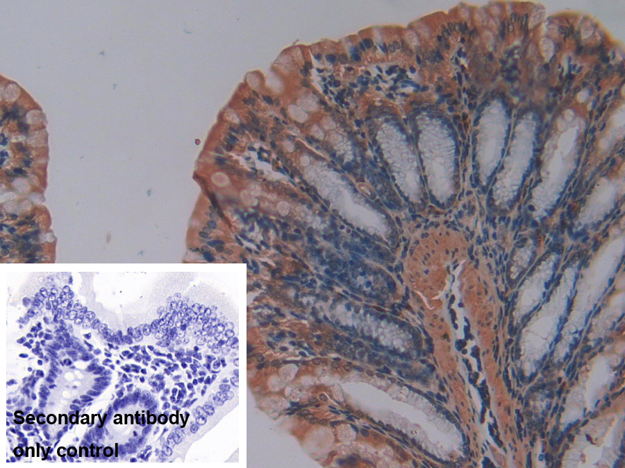 Polyclonal Antibody to Matrix Metalloproteinase 7 (MMP7)