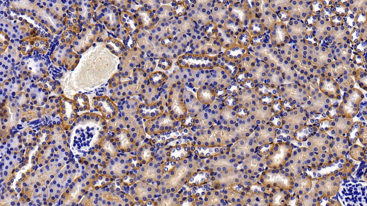 Polyclonal Antibody to Matrix Metalloproteinase 8 (MMP8)