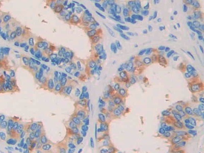 Polyclonal Antibody to Nerve Growth Factor (NGF)