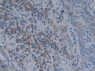 Polyclonal Antibody to Oncostatin M (OSM)