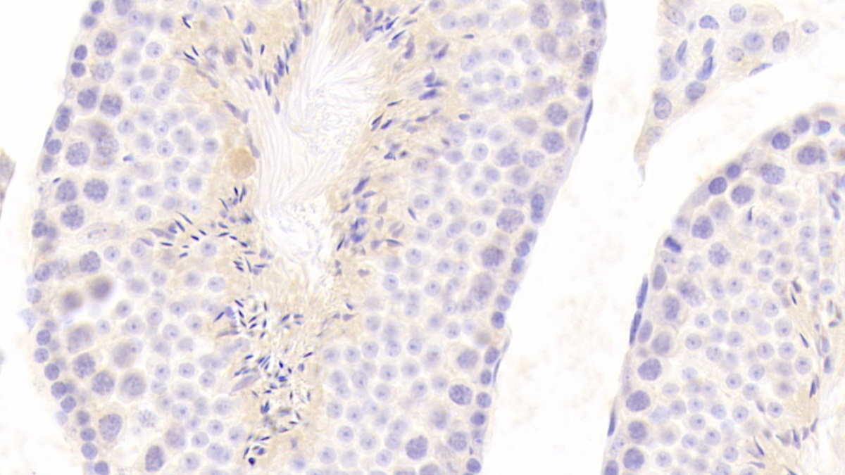 Polyclonal Antibody to Betacellulin (bTC)