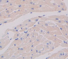 Polyclonal Antibody to Placenta Growth Factor (PLGF)