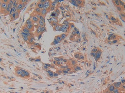 Polyclonal Antibody to Prokineticin 2 (PK2)