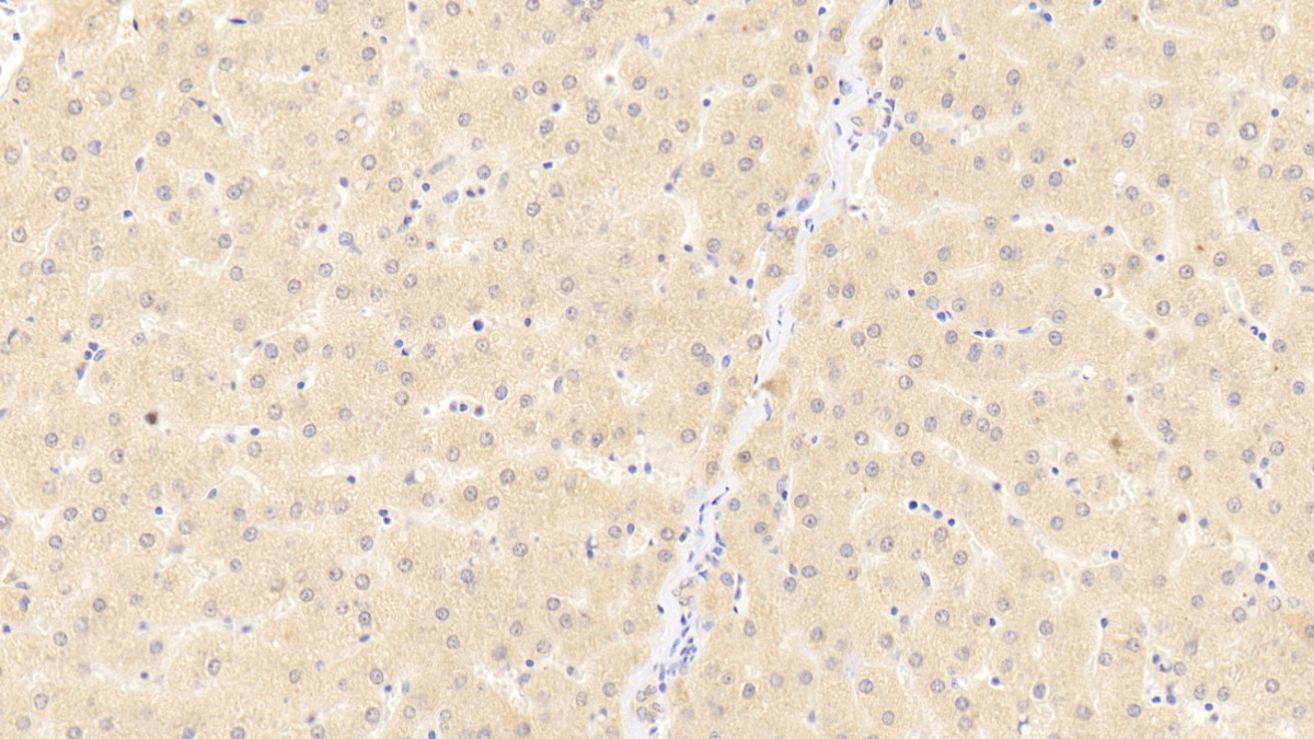 Polyclonal Antibody to Cluster Of Differentiation 40 Ligand (CD40L)
