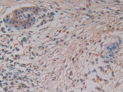 Polyclonal Antibody to Stem Cell Factor (SCF)