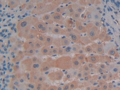 Polyclonal Antibody to Stromal Cell Derived Factor 1 (SDF1)