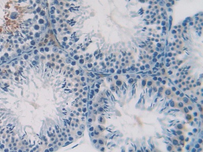 Polyclonal Antibody to Stromal Cell Derived Factor 1 (SDF1)