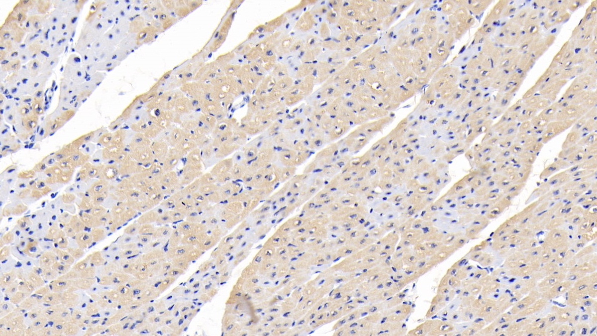 Polyclonal Antibody to Transforming Growth Factor Beta 1 (TGFb1)