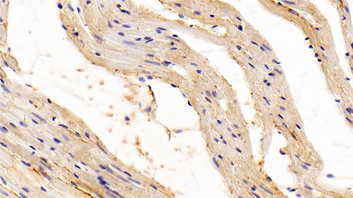 Polyclonal Antibody to Transforming Growth Factor Beta 1 (TGFb1)