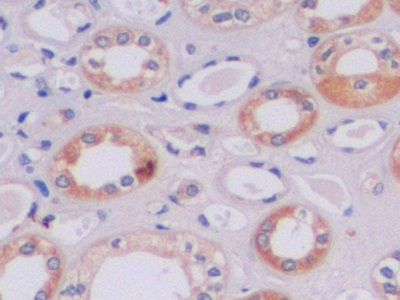 Polyclonal Antibody to Tissue Inhibitors Of Metalloproteinase 2 (TIMP2)