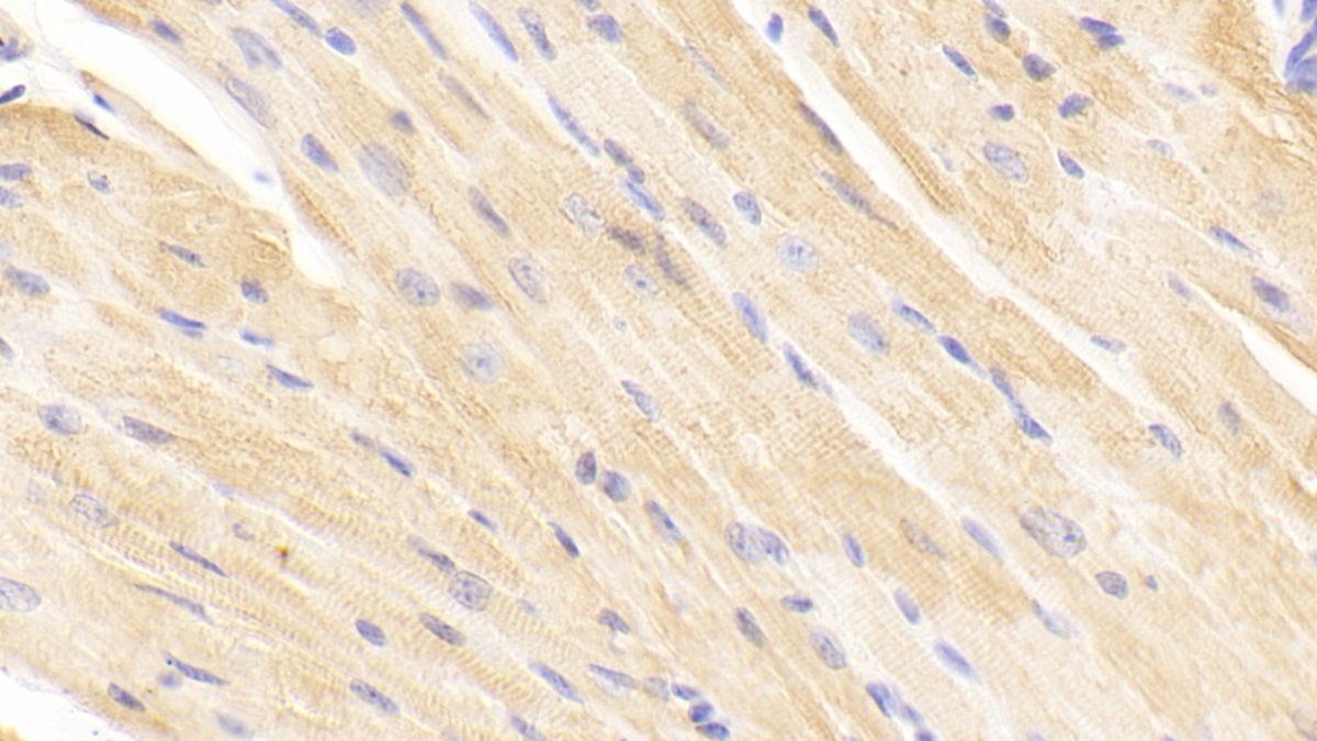 Polyclonal Antibody to Tissue Inhibitors Of Metalloproteinase 2 (TIMP2)