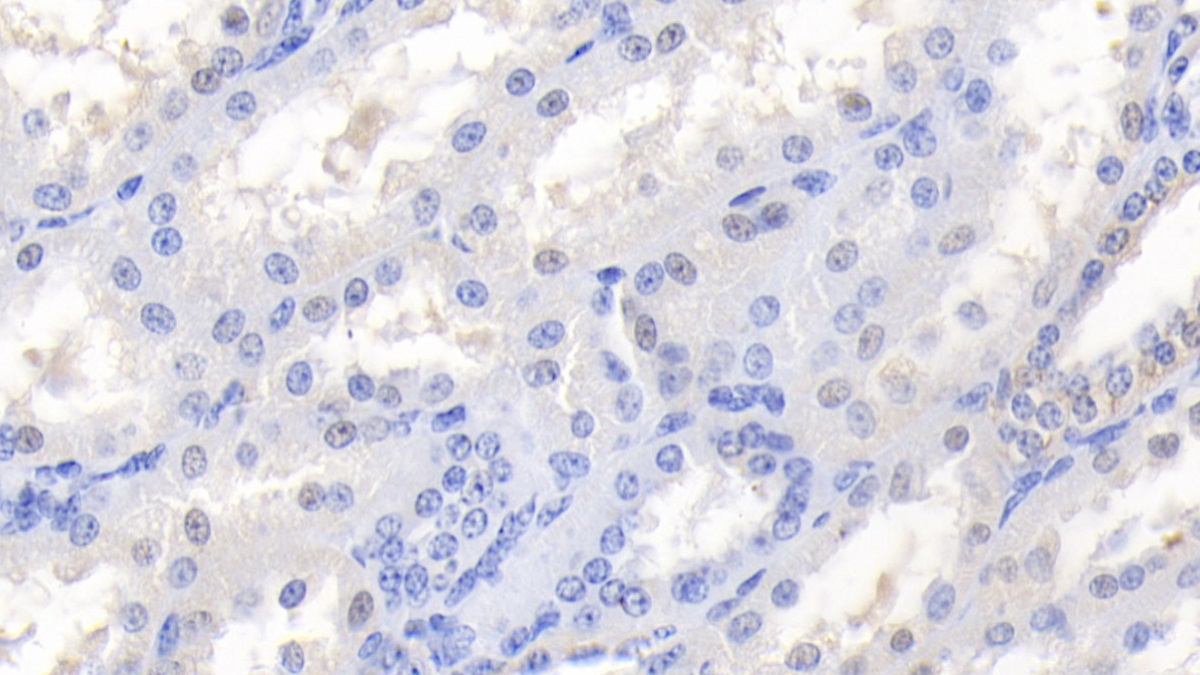 Polyclonal Antibody to Tissue Inhibitors Of Metalloproteinase 3 (TIMP3)