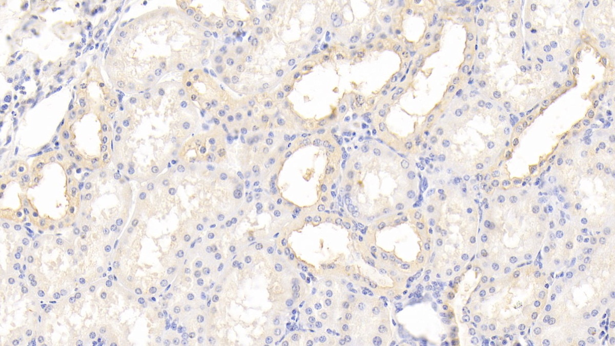 Polyclonal Antibody to Tissue Inhibitors Of Metalloproteinase 3 (TIMP3)