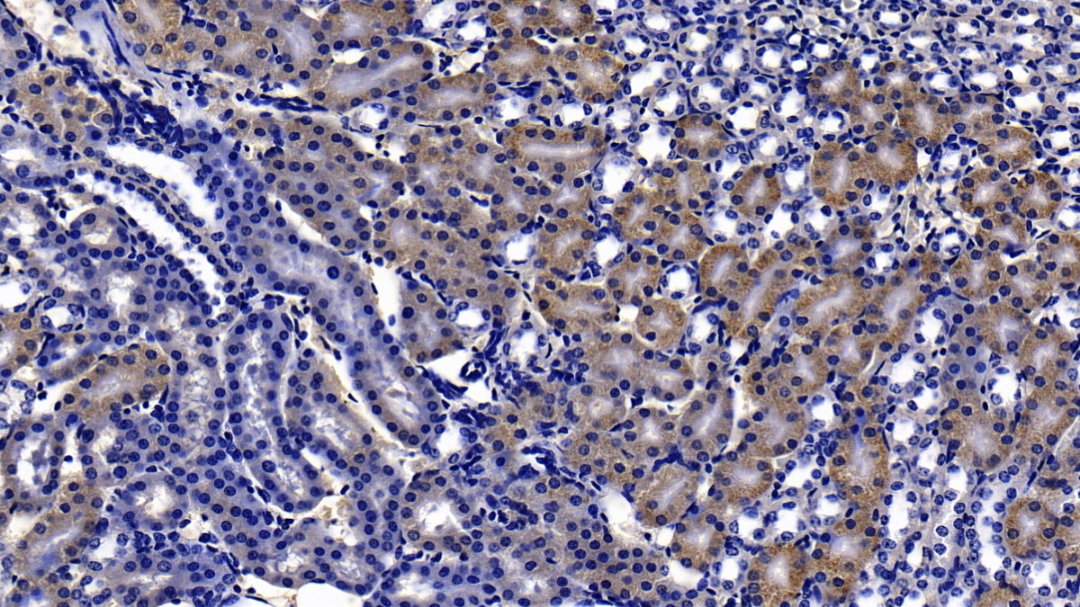 Polyclonal Antibody to Tissue Inhibitors Of Metalloproteinase 4 (TIMP4)