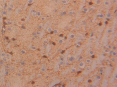 Polyclonal Antibody to Tissue Inhibitors Of Metalloproteinase 4 (TIMP4)