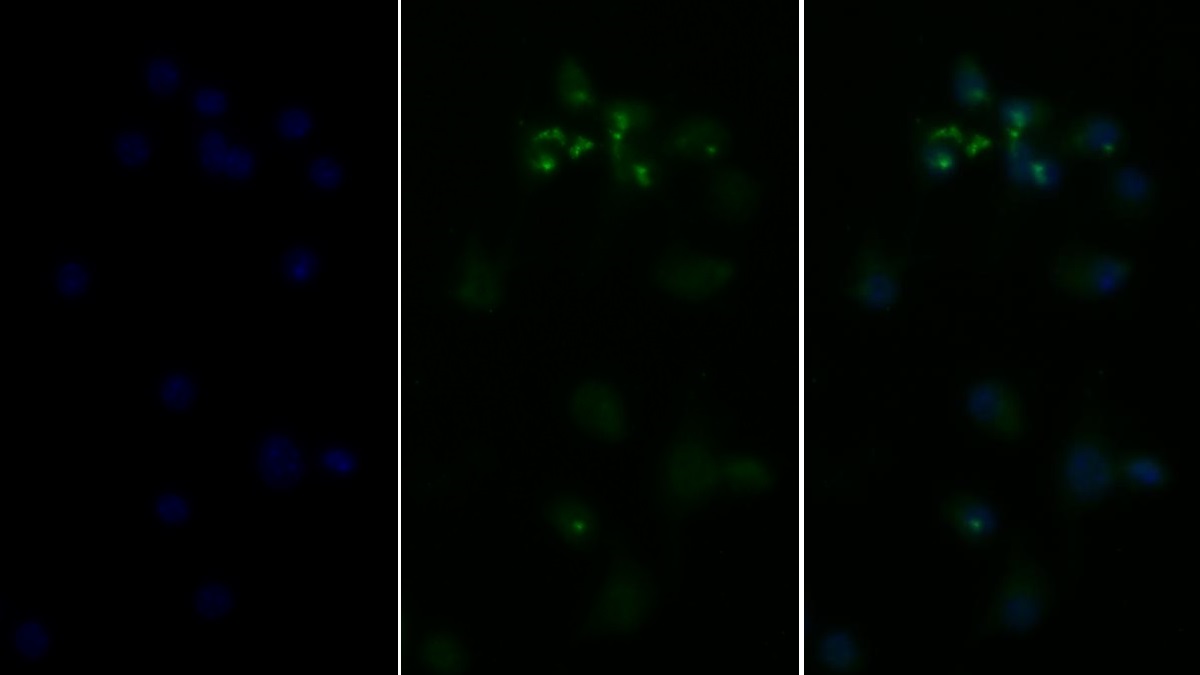 Polyclonal Antibody to Tumor Necrosis Factor Alpha (TNFa)