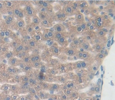 Polyclonal Antibody to Tumor Necrosis Factor Beta (TNFb)