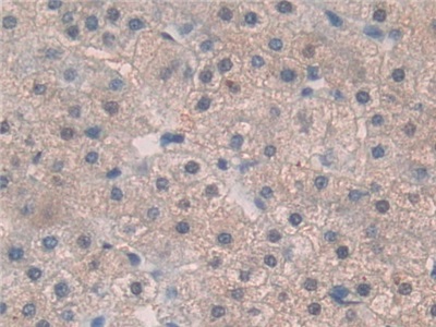 Polyclonal Antibody to Thrombopoietin (TPO)