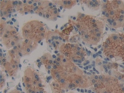 Polyclonal Antibody to Thrombopoietin (TPO)