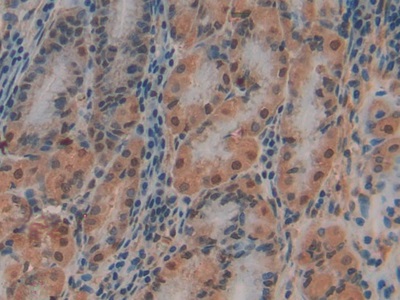 Polyclonal Antibody to Plasminogen Activator, Urokinase Receptor (uPAR)