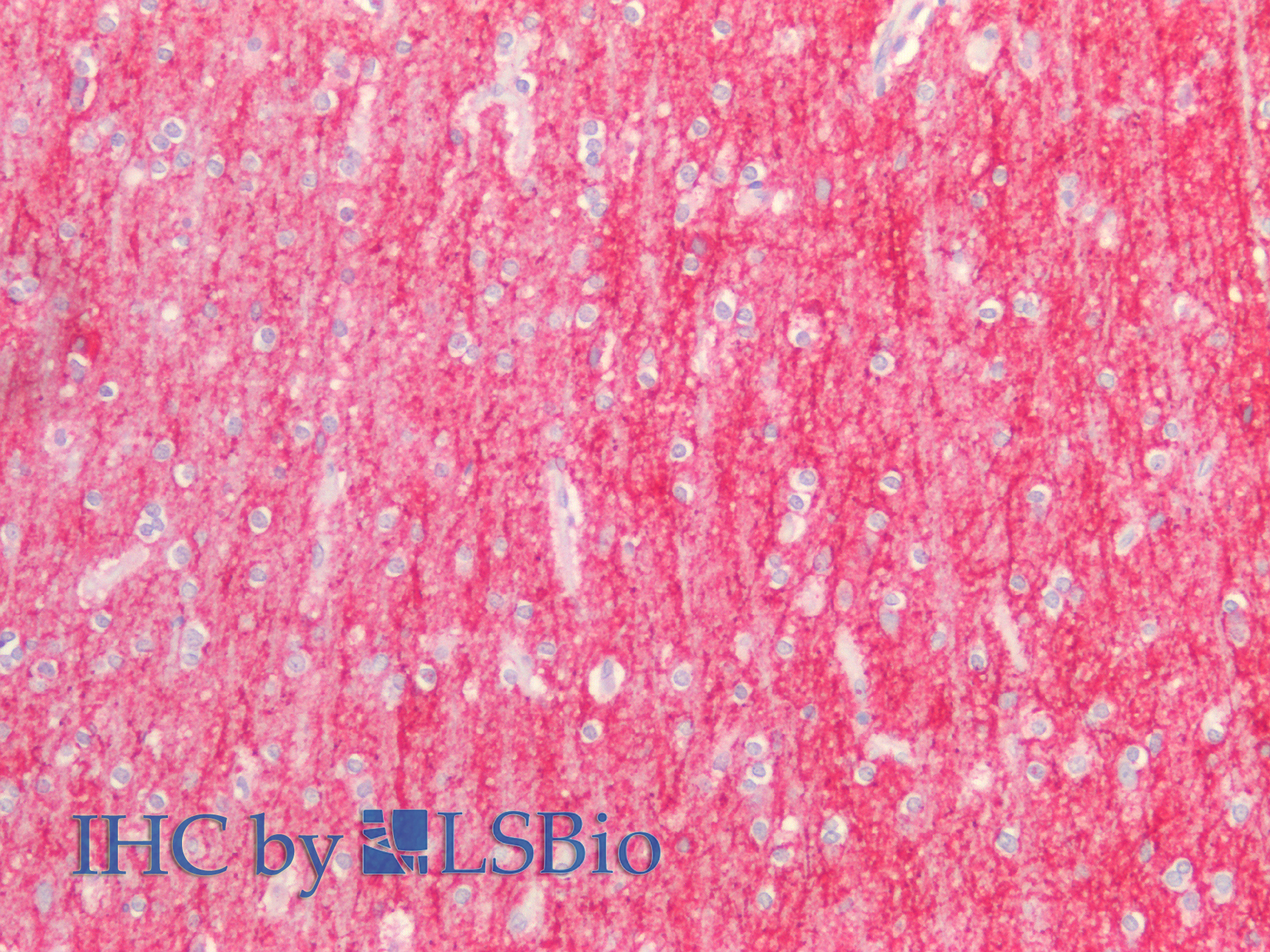 Polyclonal Antibody to Intercellular Adhesion Molecule 5 (ICAM5)