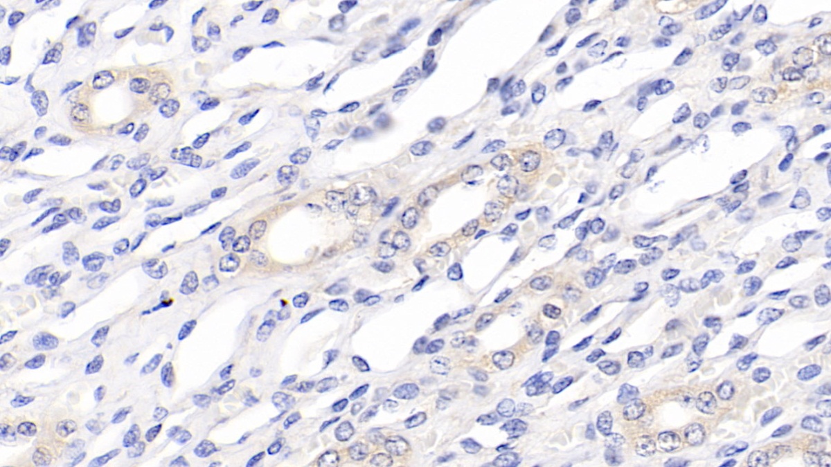 Polyclonal Antibody to Vascular Endothelial Growth Factor A (VEGFA)