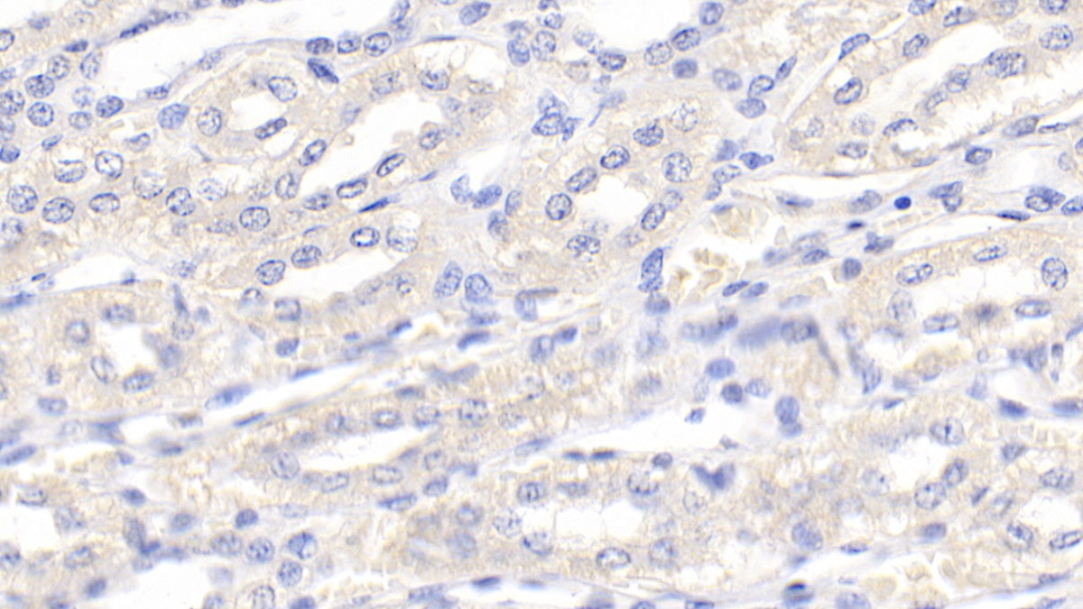 Polyclonal Antibody to Vascular Endothelial Growth Factor B (VEGFB)