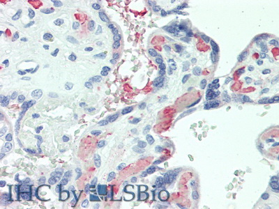 Polyclonal Antibody to Vascular Endothelial Growth Factor B (VEGFB)