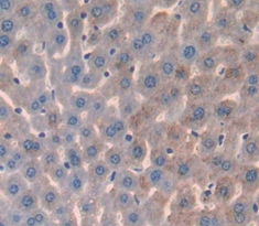 Polyclonal Antibody to Prostate Specific Antigen (PSA)