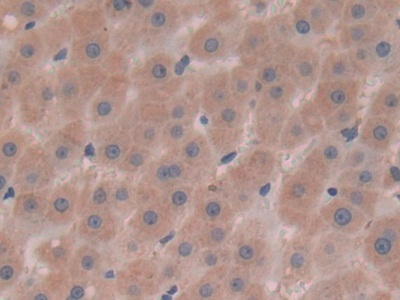 Polyclonal Antibody to Alpha-Fetoprotein (AFP)