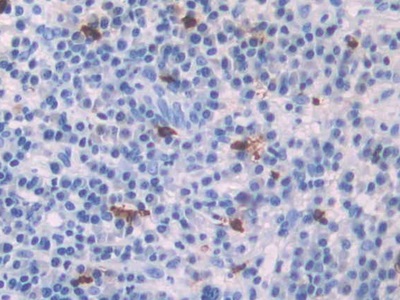 Polyclonal Antibody to Platelet Factor 4 (PF4)