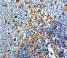 Polyclonal Antibody to Platelet Factor 4 (PF4)