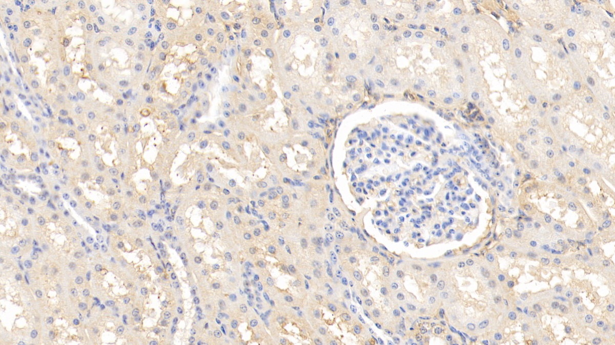 Polyclonal Antibody to Alpha-2-Heremans Schmid Glycoprotein (AHSG)