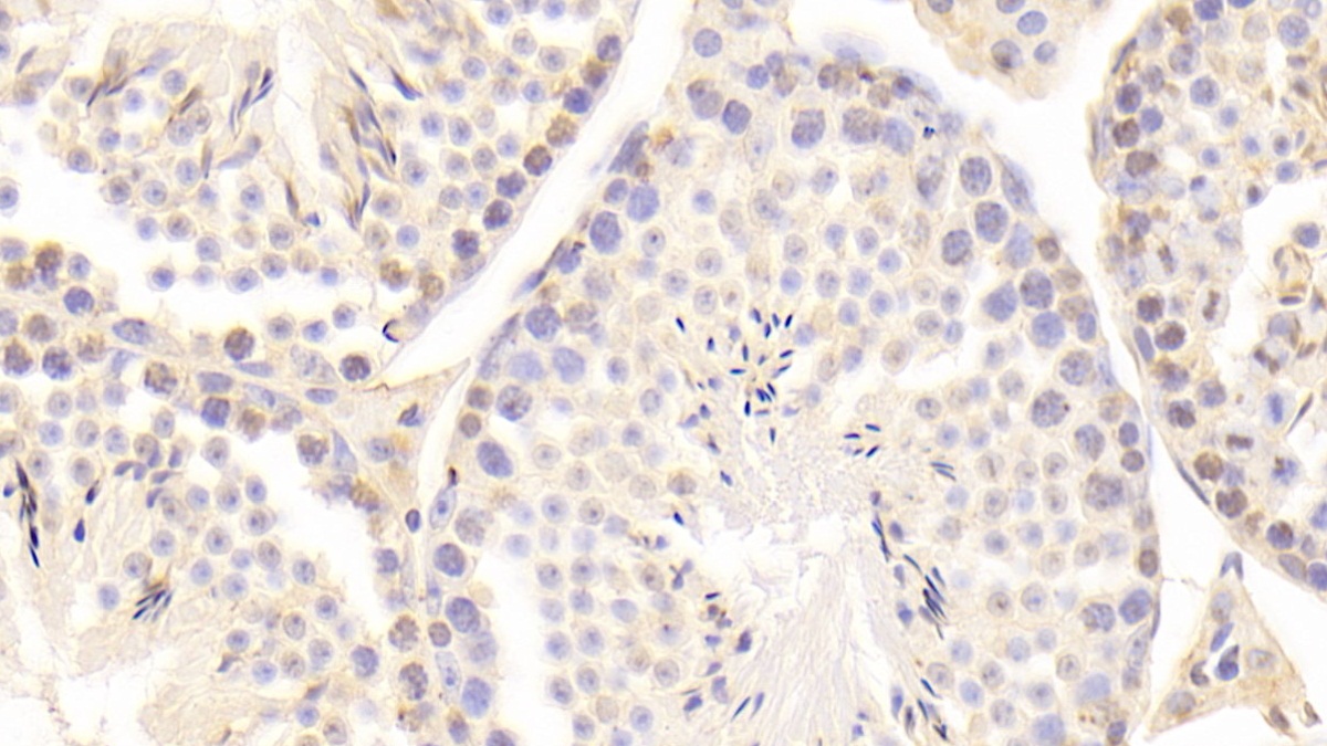Polyclonal Antibody to Growth Arrest Specific Protein 6 (GAS6)
