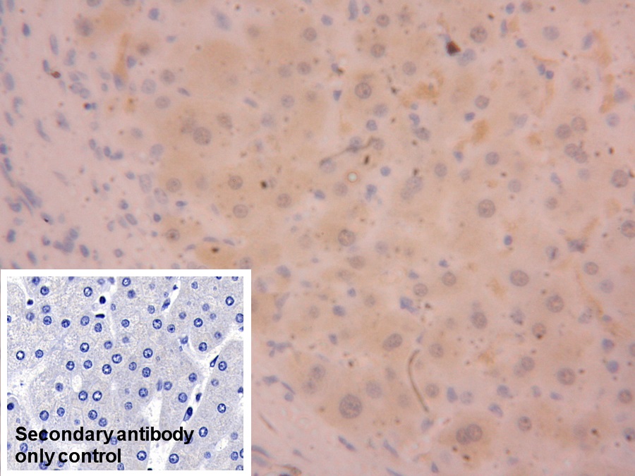 Polyclonal Antibody to Alanine Aminotransferase (ALT)