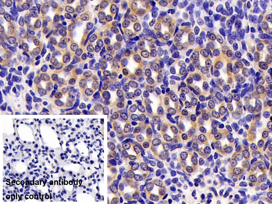 Polyclonal Antibody to Alanine Aminotransferase (ALT)