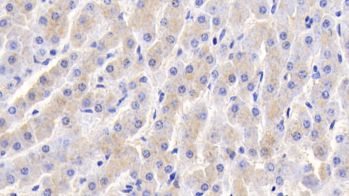 Polyclonal Antibody to Triggering Receptor Expressed On Myeloid Cells 1 (TREM1)