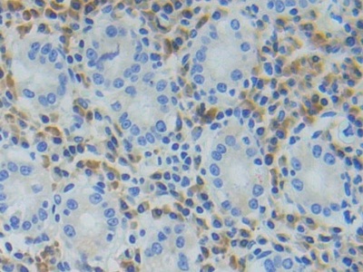 Polyclonal Antibody to Triggering Receptor Expressed On Myeloid Cells 1 (TREM1)