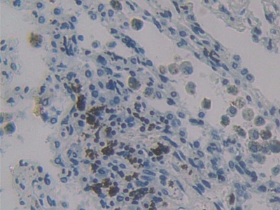 Polyclonal Antibody to Monocyte Chemotactic Protein 4 (MCP4)