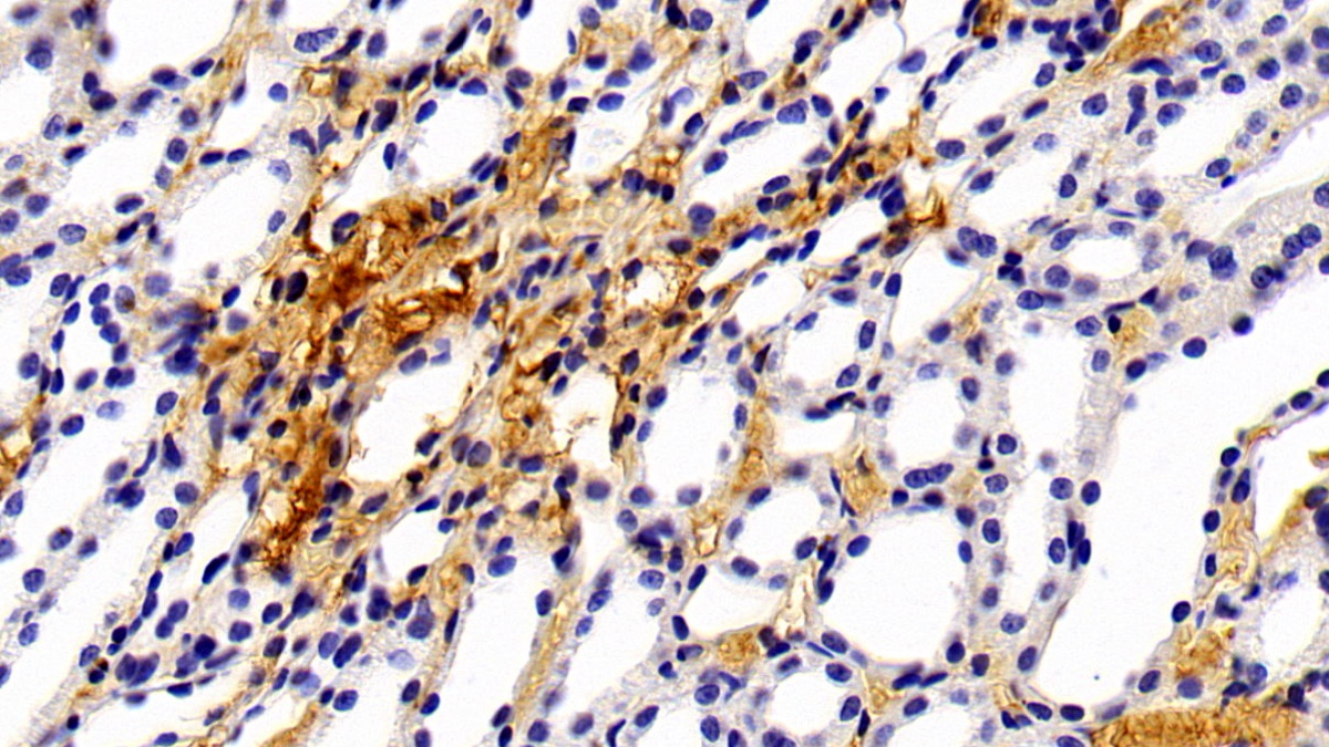 Polyclonal Antibody to Alpha-1-Microglobulin (a1M)