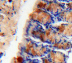 Polyclonal Antibody to Urocortin (UCN)