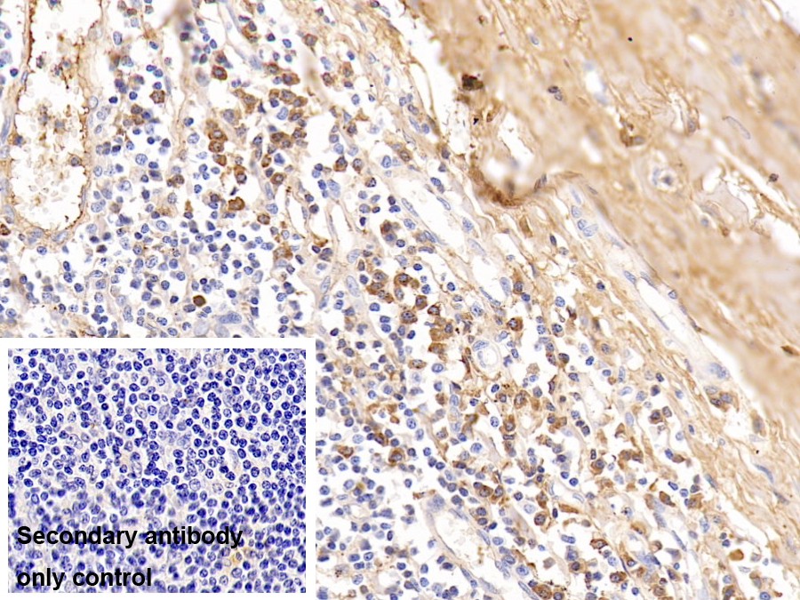 Polyclonal Antibody to Immunoglobulin G4 (IgG4)