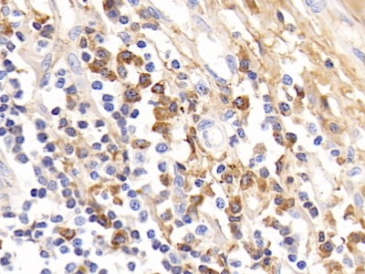 Polyclonal Antibody to Immunoglobulin G4 (IgG4)